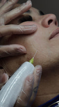 Fibroblast