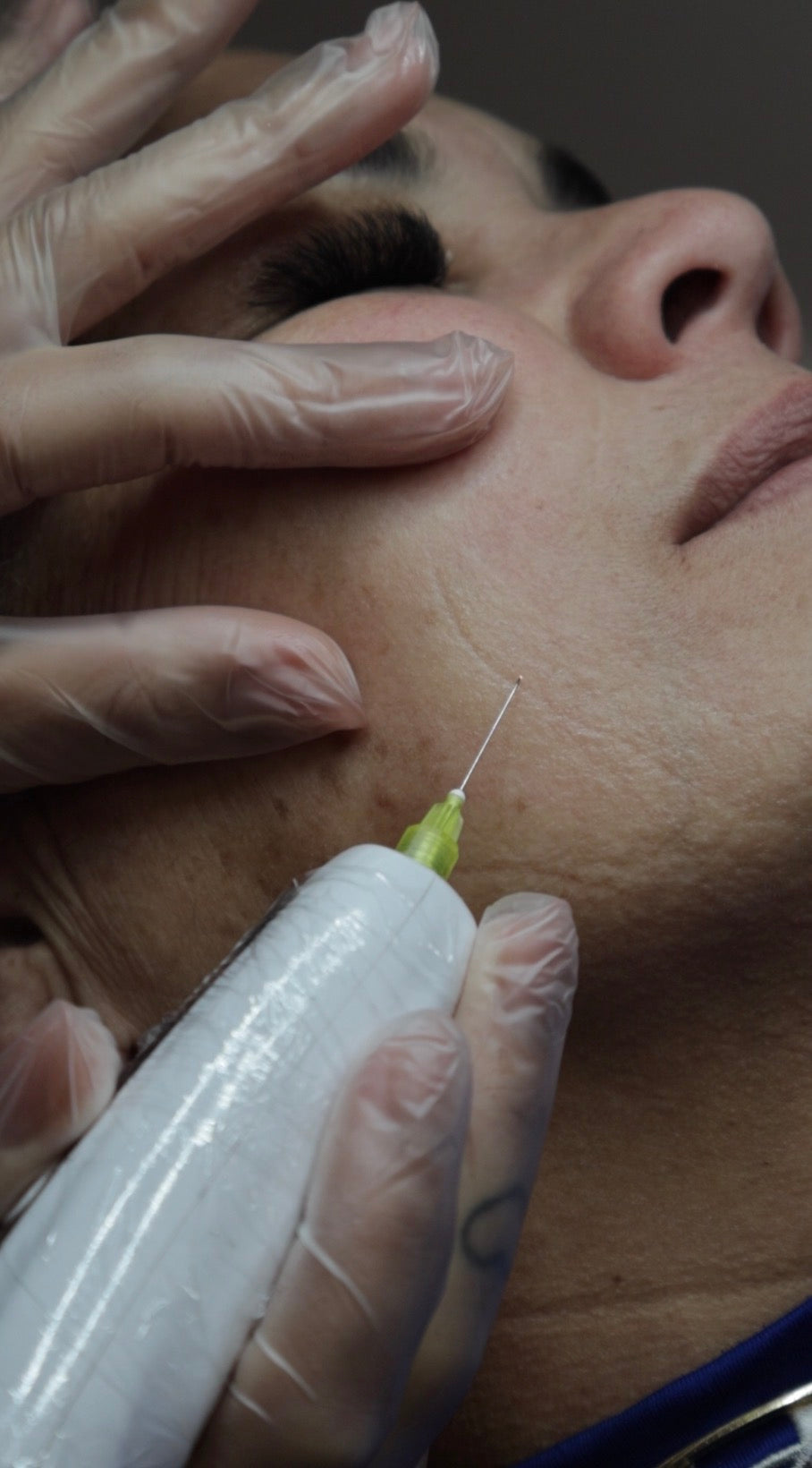 Fibroblast