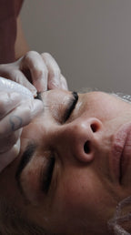 Fibroblast